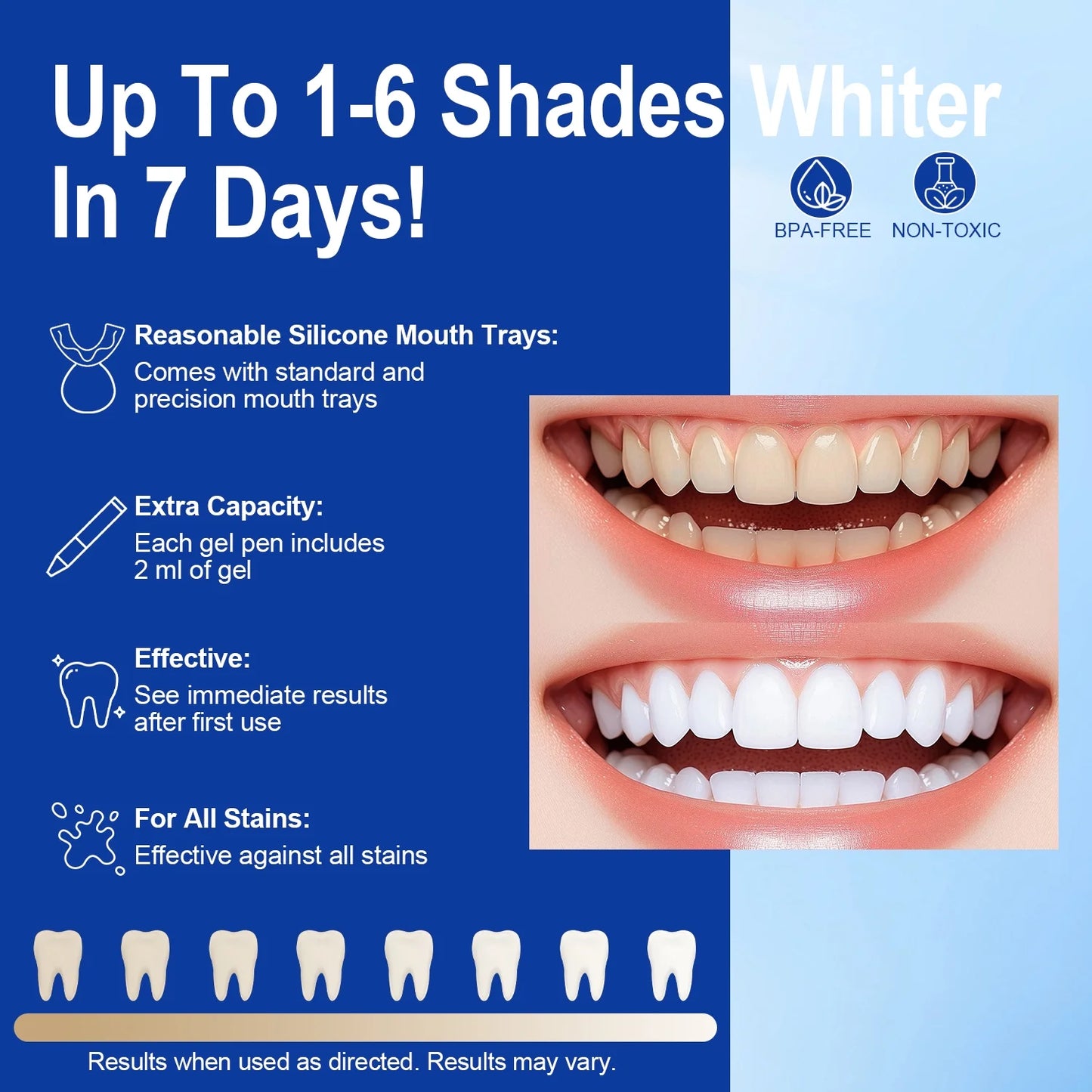 MOONORAH Teeth Whitening Kit, Teeth Whitening Light with Mouth Trays with 16 Accelerator LED light, 4 Teeth Whitening Gel for Sensitive Teeth, Professional Level Whitening Set, Rechargeable